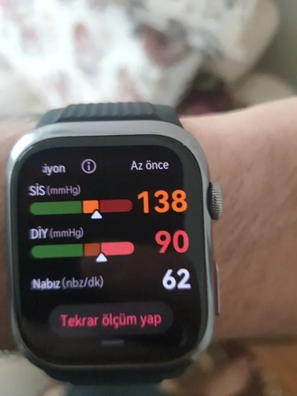 Huaweı Watch D2 – Kauçuk