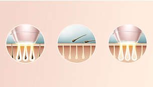 Philips Lumea BRI950/00 Lumea Lazer Epilasyon IPL Tüy Alma Cihazı Yüz+Vücut+Hassas Bölge Kullanımı,Kablolu/Kablosuz Kullanım